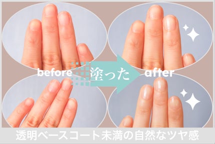 エテュセ クイックケアコート/ettusais/ネイルオイル・トリートメントを使ったクチコミ(1枚目)