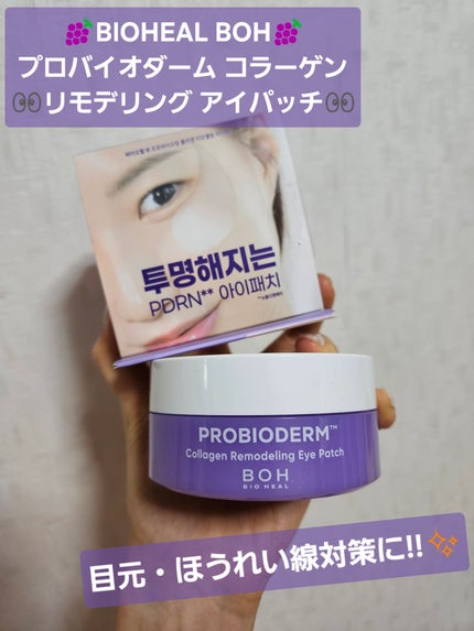プロバイオダーム コラーゲン リモデリング アイパッチ/BIOHEAL BOH/アイケア・アイクリームを使ったクチコミ(1枚目)