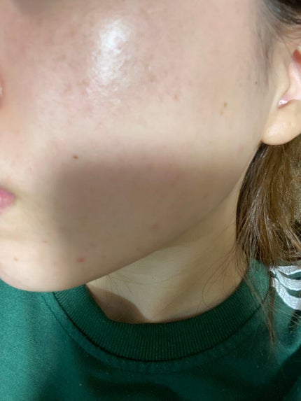 ティーツリーウォーター/ラッシュ/ミスト状化粧水を使ったクチコミ(4枚目)