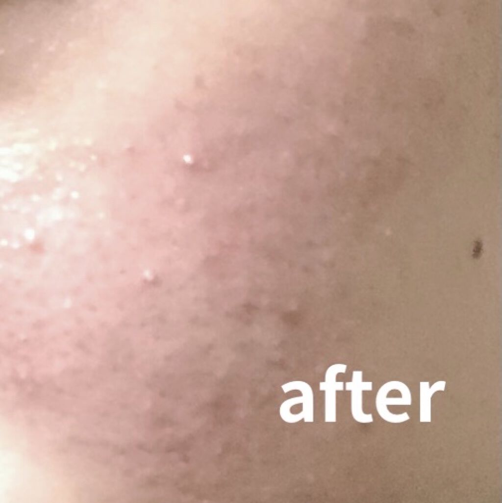 CICA デイリースージングマスク/VT/シートマスク・パックを使ったクチコミ（3枚目）