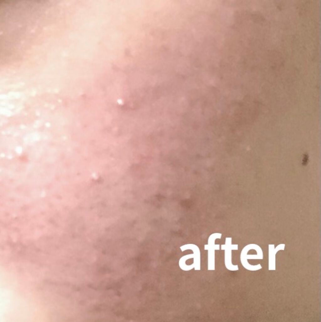 CICA デイリースージングマスク/VT/シートマスク・パックを使ったクチコミ(3枚目)