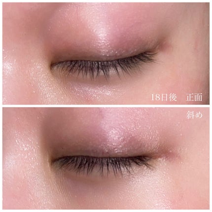 アイラッシュソリューションセラム/Milk Touch/まつげ美容液を使ったクチコミ(5枚目)