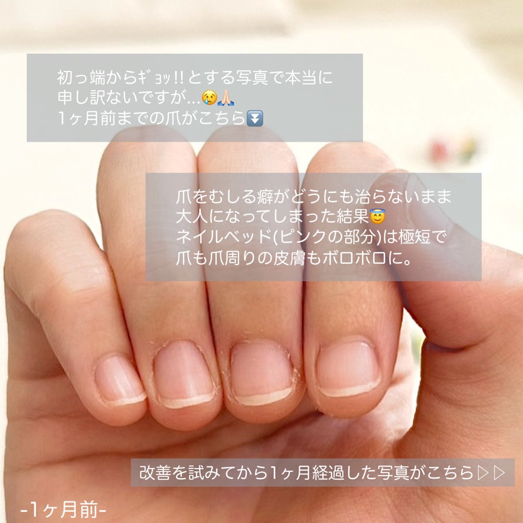 甘皮ケアオイル/無印良品/ネイルオイル・トリートメントを使ったクチコミ(2枚目)