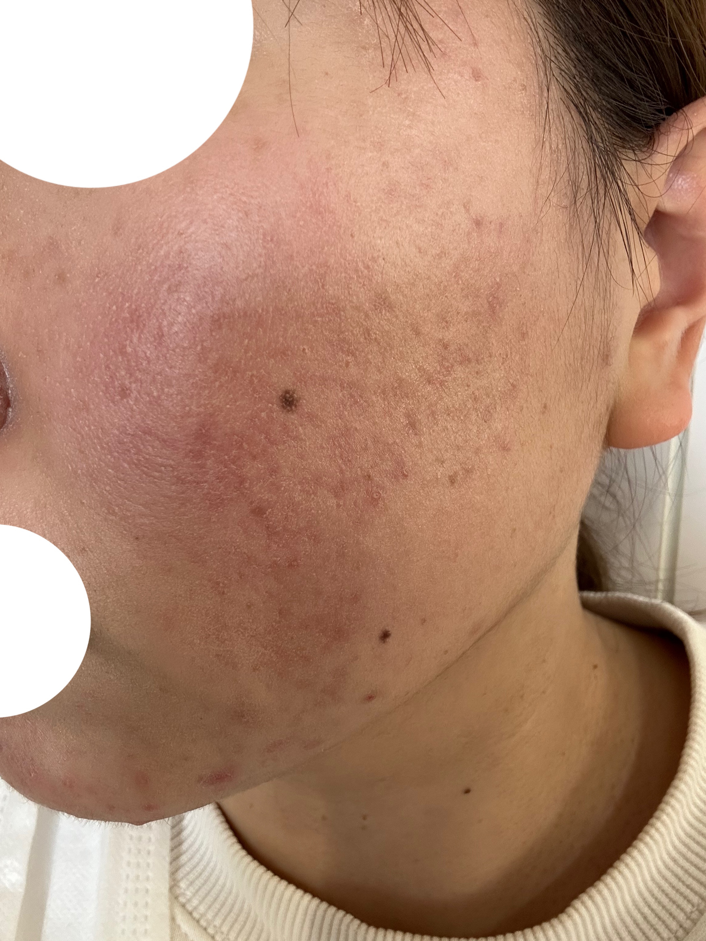 Zセバムドライングパウダー/ETUDE/フェイスパウダーを使ったクチコミ（2枚目）