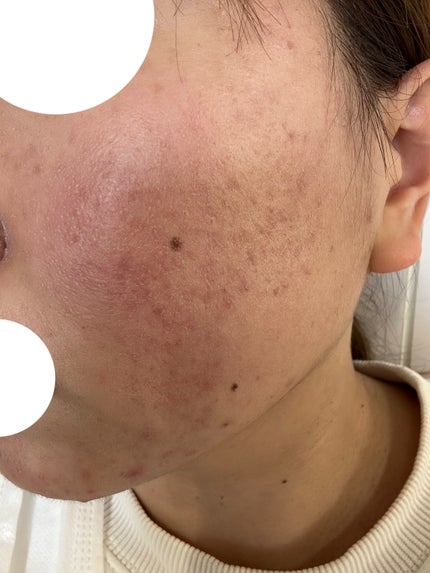 ミシャ グロウ スキンバーム(R)/MISSHA/化粧下地を使ったクチコミ(2枚目)