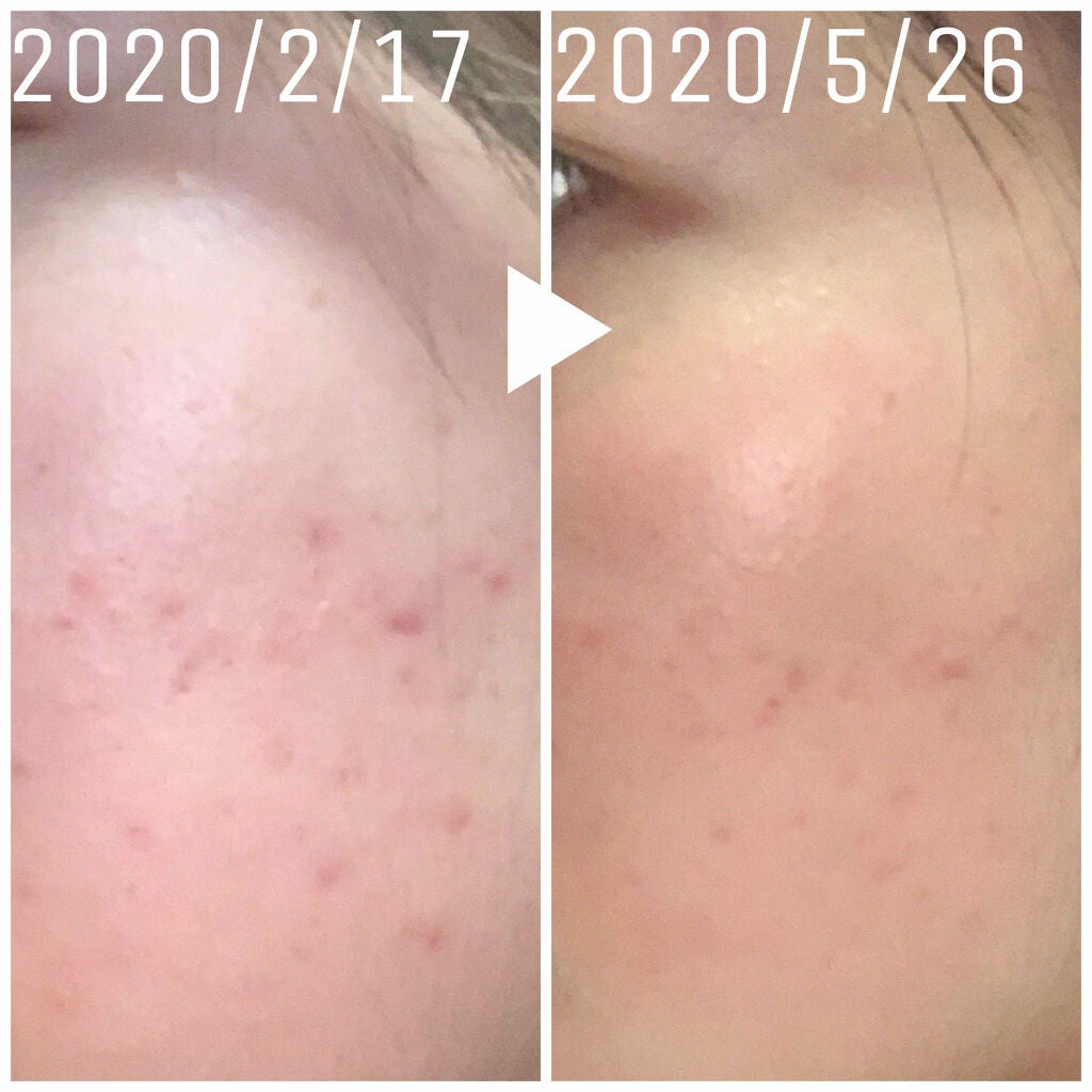 化粧水・敏感肌用・しっとりタイプ/無印良品/化粧水を使ったクチコミ(3枚目)