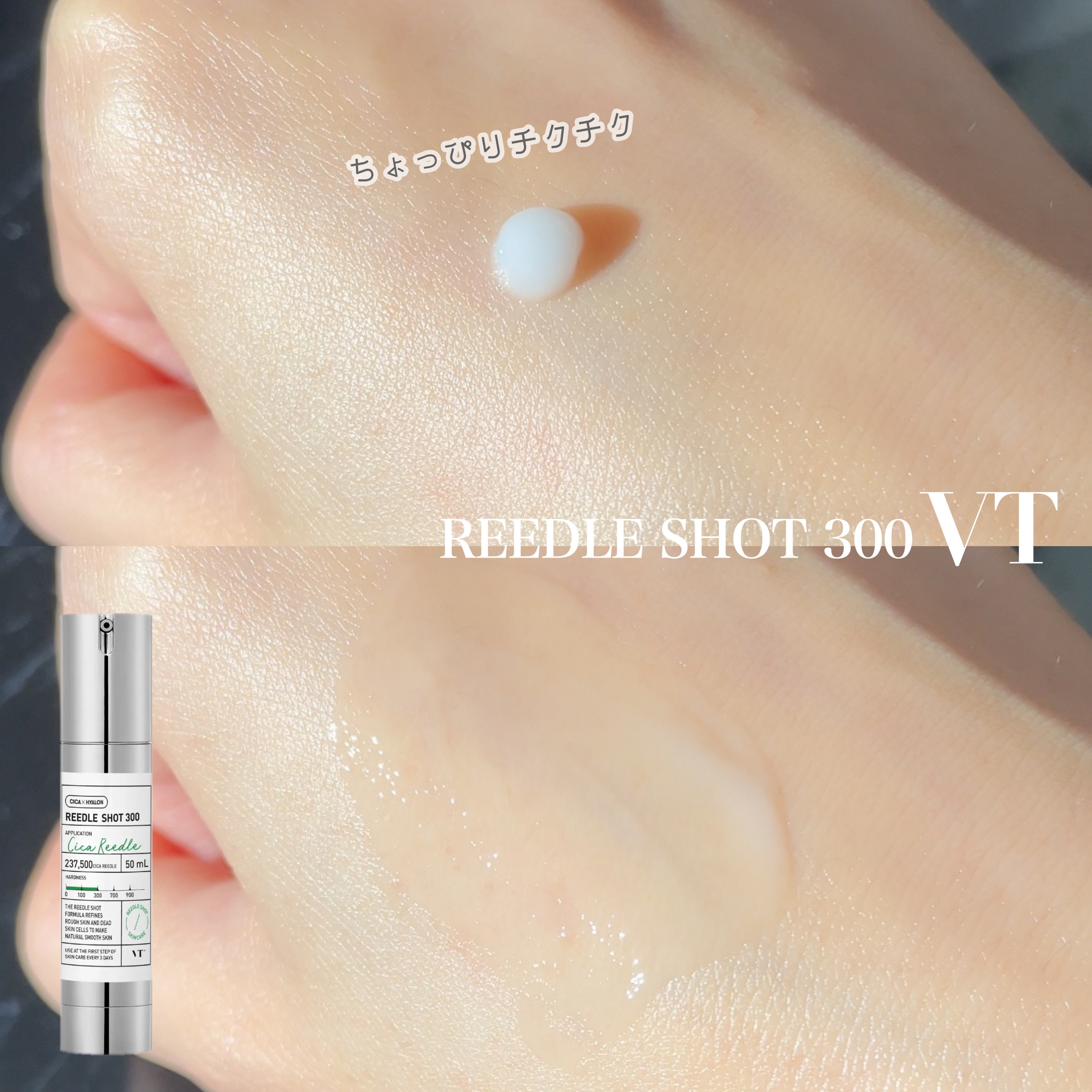 リードルショット300/VT/美容液を使ったクチコミ（3枚目）