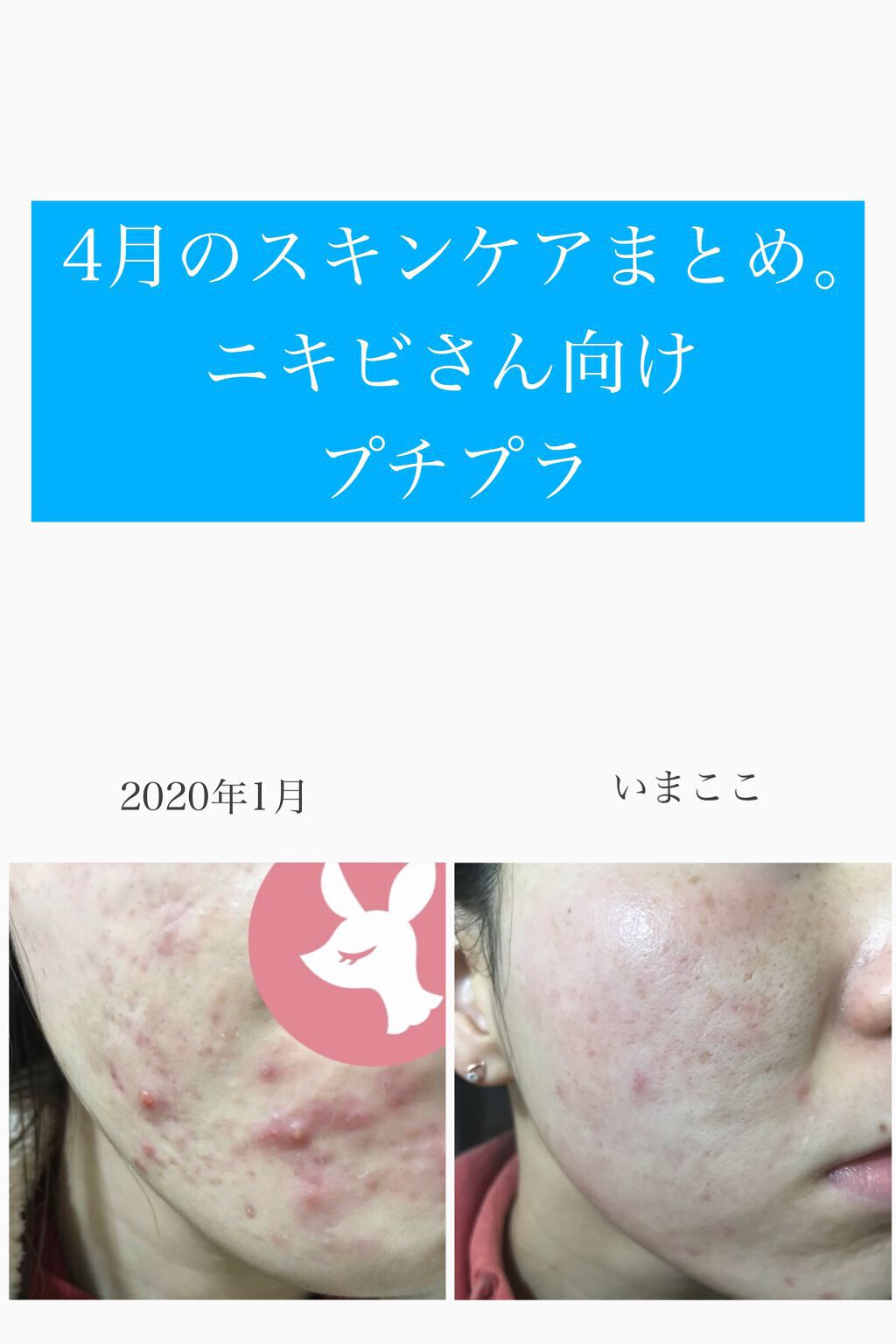 シャボン玉浴用/シャボン玉石けん/ボディ石鹸を使ったクチコミ（1枚目）