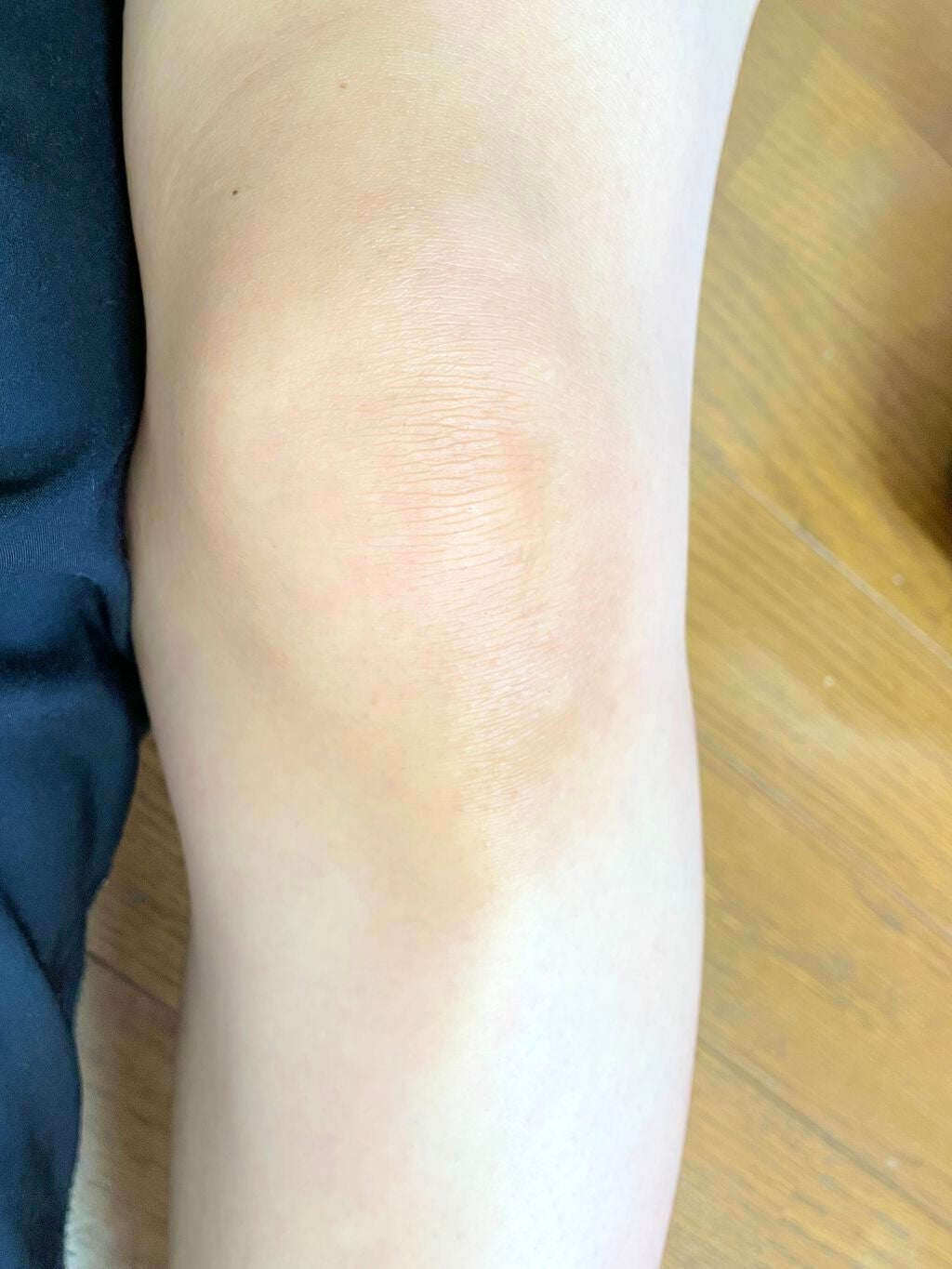 ザーネクリーム/ザーネ/ボディクリームを使ったクチコミ(3枚目)