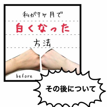 以前に投稿してからサプリメントやスキンケアが変わったので、また投稿させていただきます✨


[サプリメント]
マルチビタミン(DHC)→ビタミンC(DHC)
ビタミンB(DHC)を追加
[はとむぎエキス