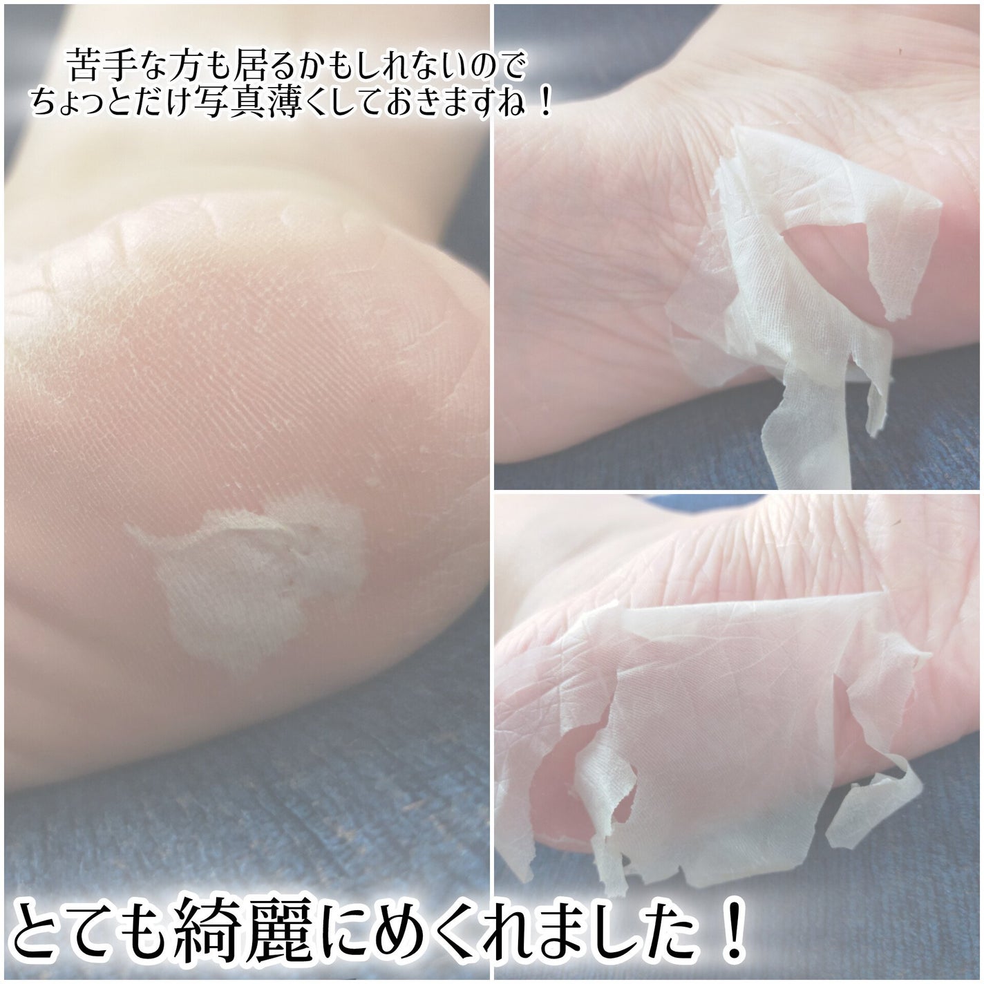 足裏角質ケアパック/3COINS/レッグ・フットケアを使ったクチコミ(5枚目)
