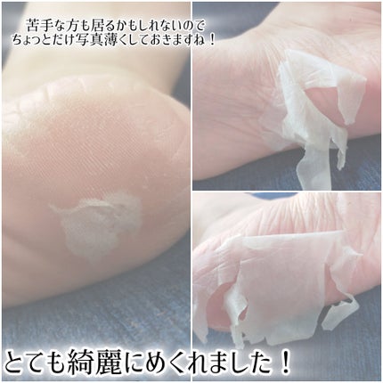 足裏角質ケアパック/3COINS/レッグ・フットケアを使ったクチコミ(5枚目)