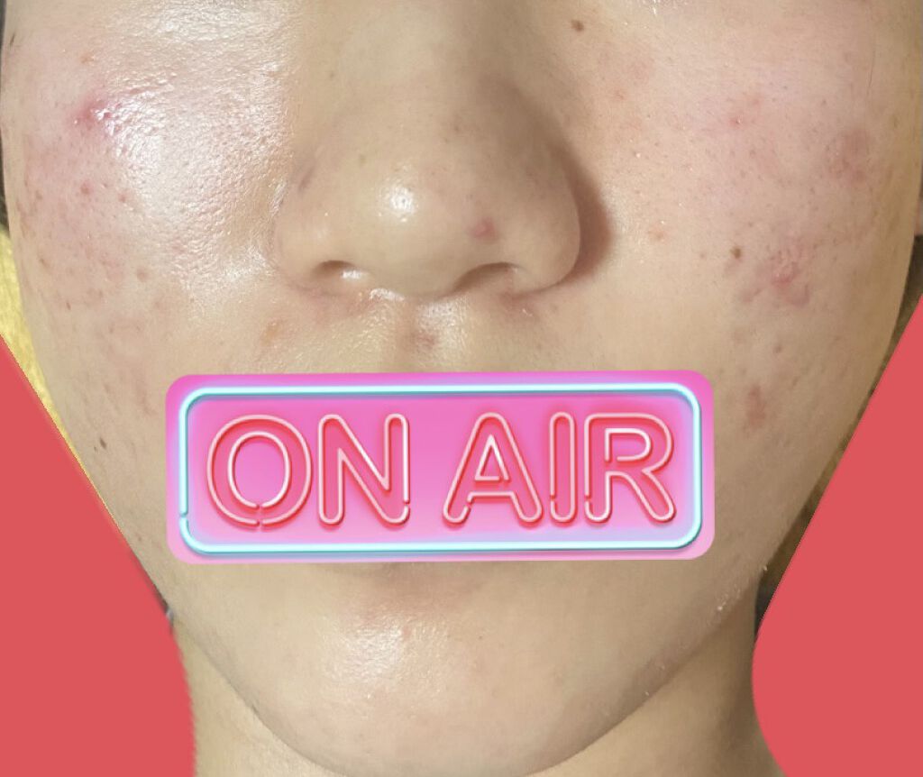 ウオーター/アベンヌ/ミスト状化粧水を使ったクチコミ（1枚目）