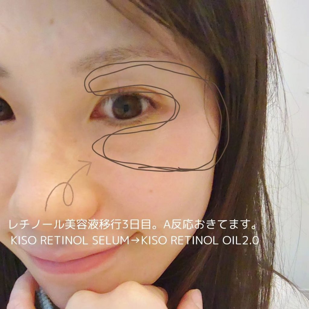 オイルセラムRE2/KISO/美容液を使ったクチコミ（3枚目）