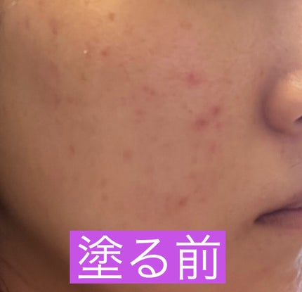 (旧)アンリミテッド ラスティング フルイド/shu uemura/リキッドファンデーションを使ったクチコミ(7枚目)