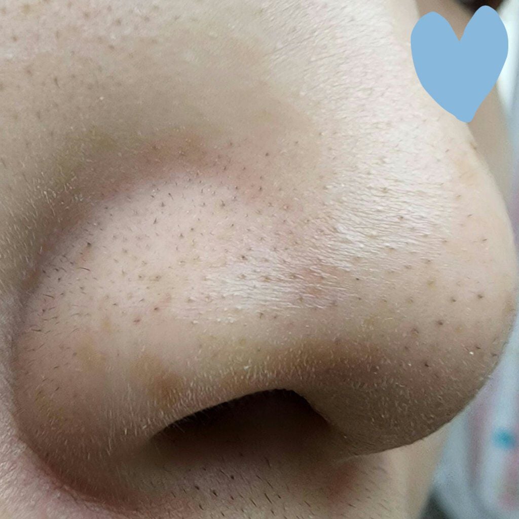 ソフィーナ iP ポア クリアリング ジェル ウォッシュ/SOFINA iP/その他洗顔料を使ったクチコミ(6枚目)