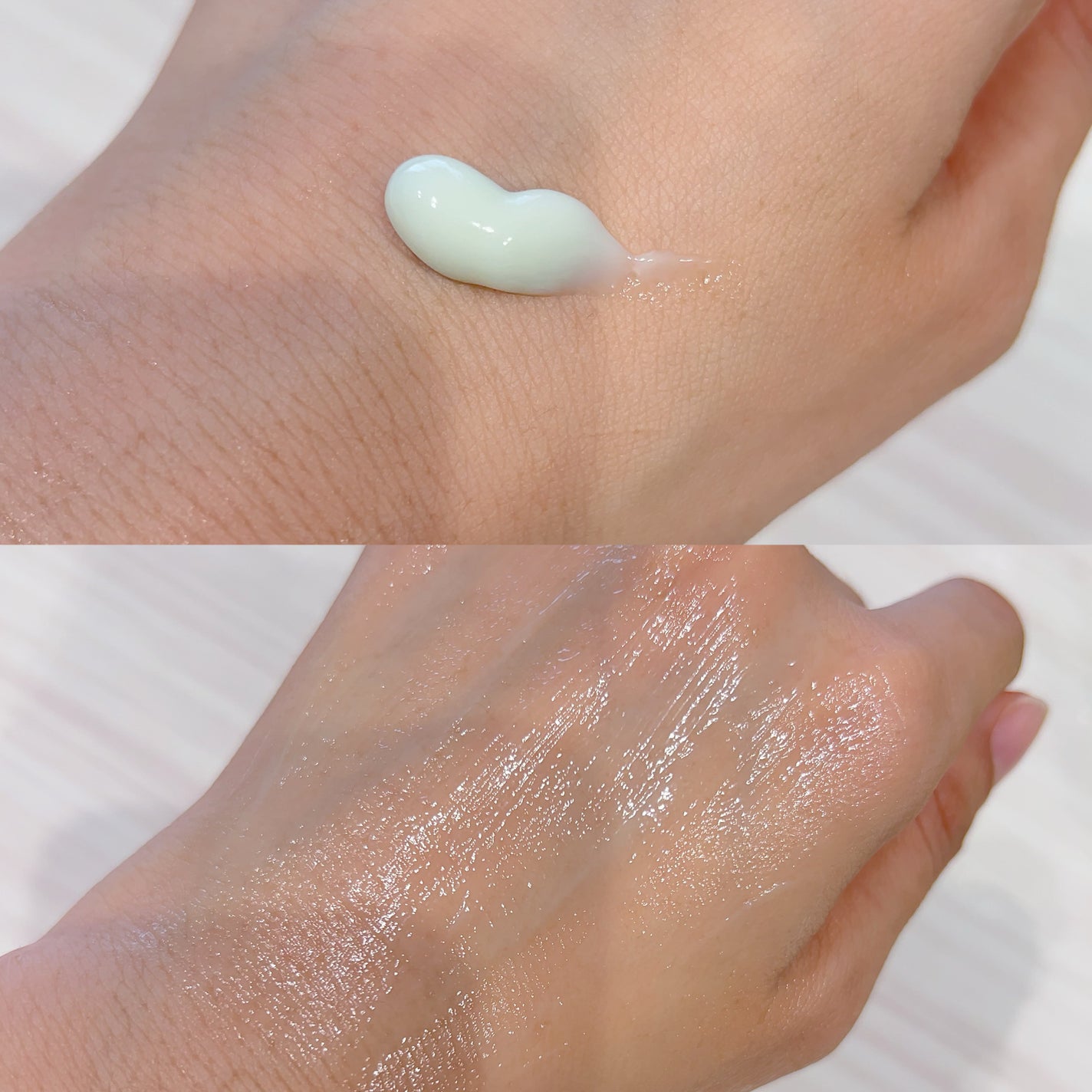 ð¶ããã¡ããð¶ on LIPS ãmedicubeæ°äœãšã¯ãœãœãŒã ã·ã«ã©ã€ã³/å
šååã«ãã·ã«ãã..ãïŒ10æç®ïŒ