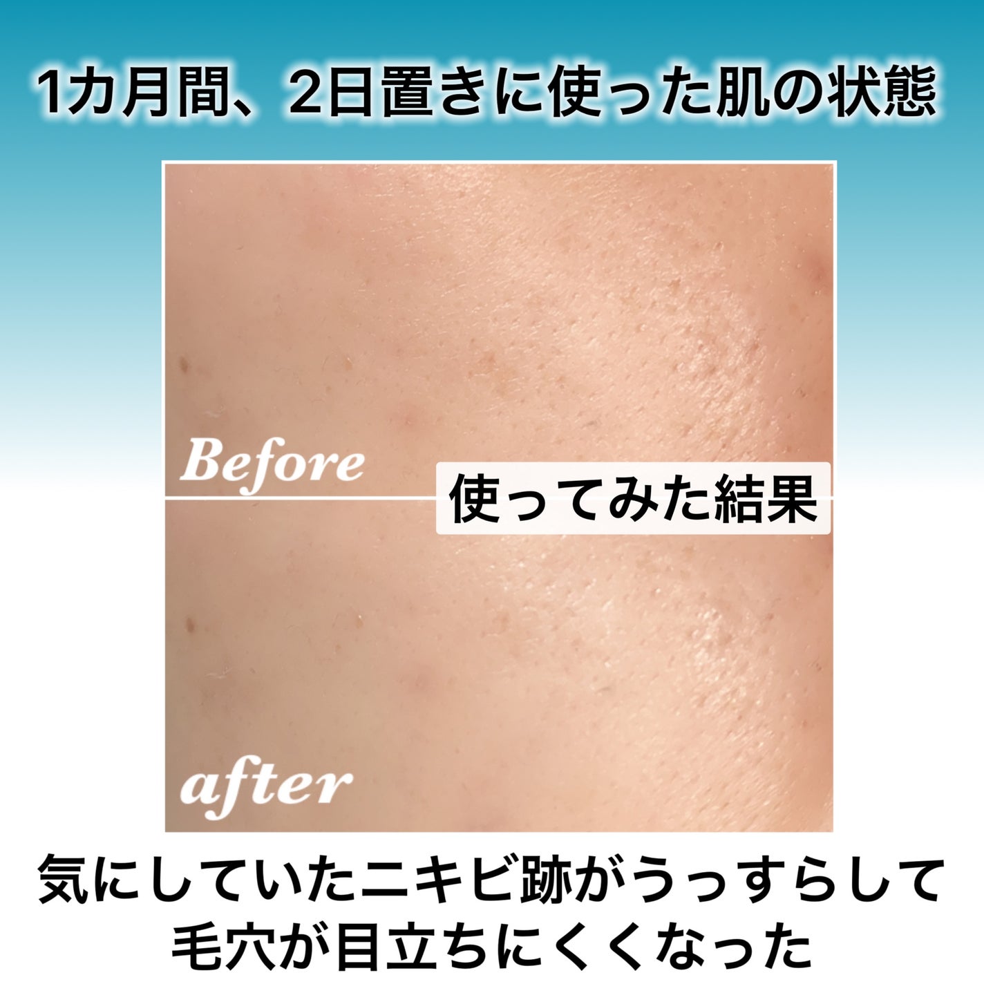 シカレチA エッセンス0.1/VT/美容液を使ったクチコミ(2枚目)