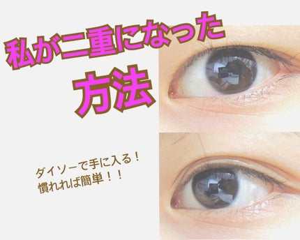 絆創膏/DAISO/その他を使ったクチコミ(1枚目)