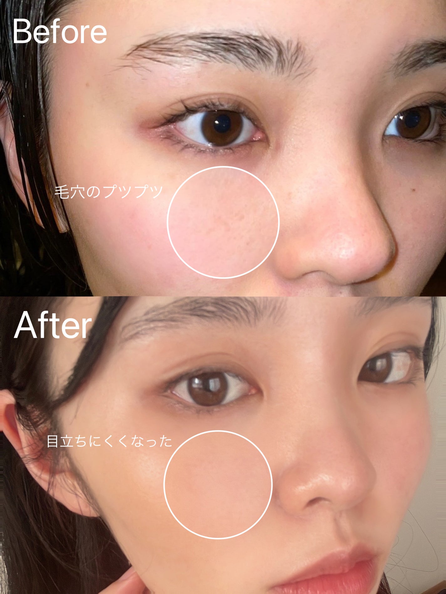 ダーマエアショット/MEDICUBE/美顔器・マッサージを使ったクチコミ(2枚目)