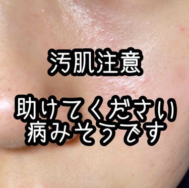 まる on LIPS 「こんなサムネイルで開いてくれた方ありがとうございます。本当に感..」（1枚目）