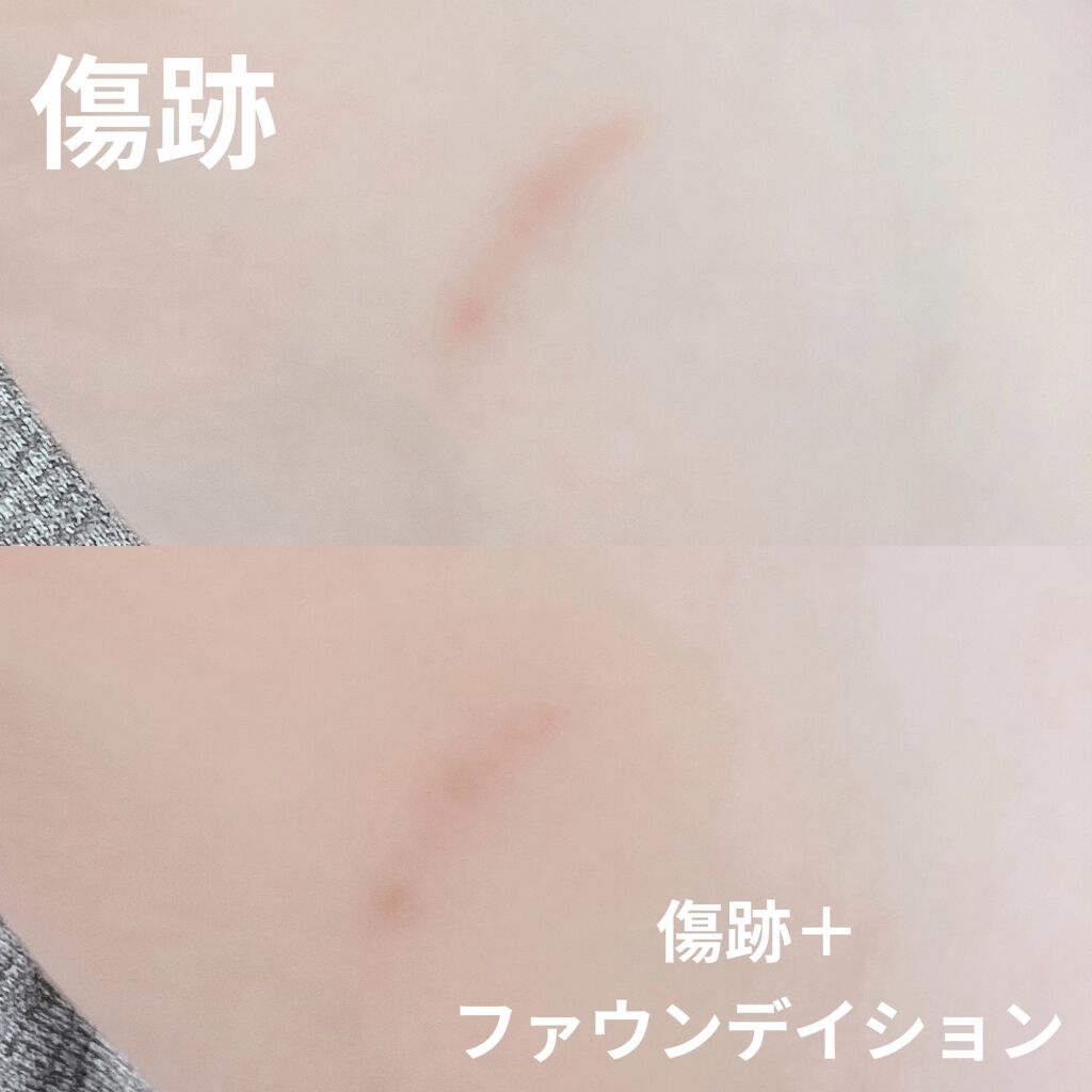 スポッツカバー ファウンデイション/SHISEIDO/クリームコンシーラーを使ったクチコミ（3枚目）