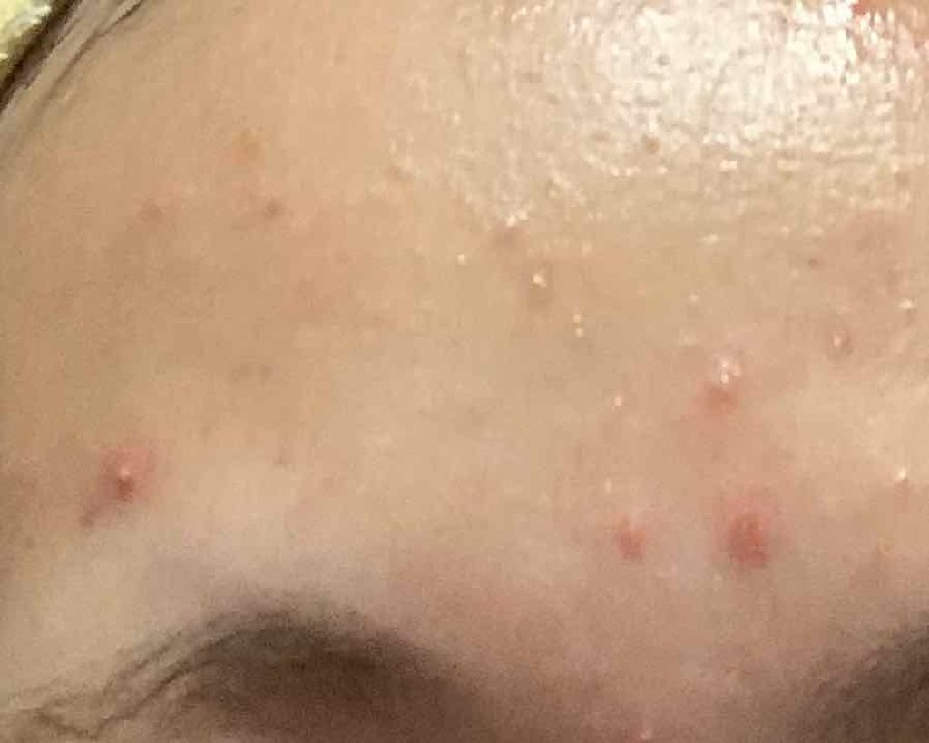 高麗美人/ていねい通販/健康サプリメントを使ったクチコミ（2枚目）