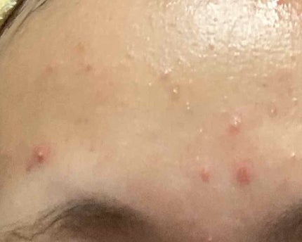 ていねい通販 高麗美人のクチコミ「汚い画像すいません…
自分の記録用に
どちらの写真もiPhoneカメラで撮影。無加工
.....」(2枚目)