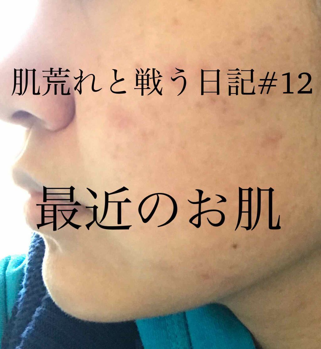 皮脂トラブルケア 化粧水/キュレル/化粧水を使ったクチコミ(1枚目)