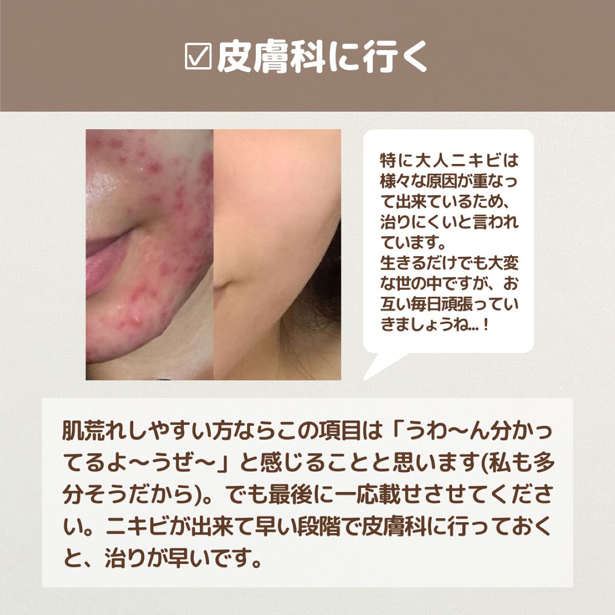 皮脂トラブルケア 保湿ジェル/キュレル/化粧水を使ったクチコミ(7枚目)