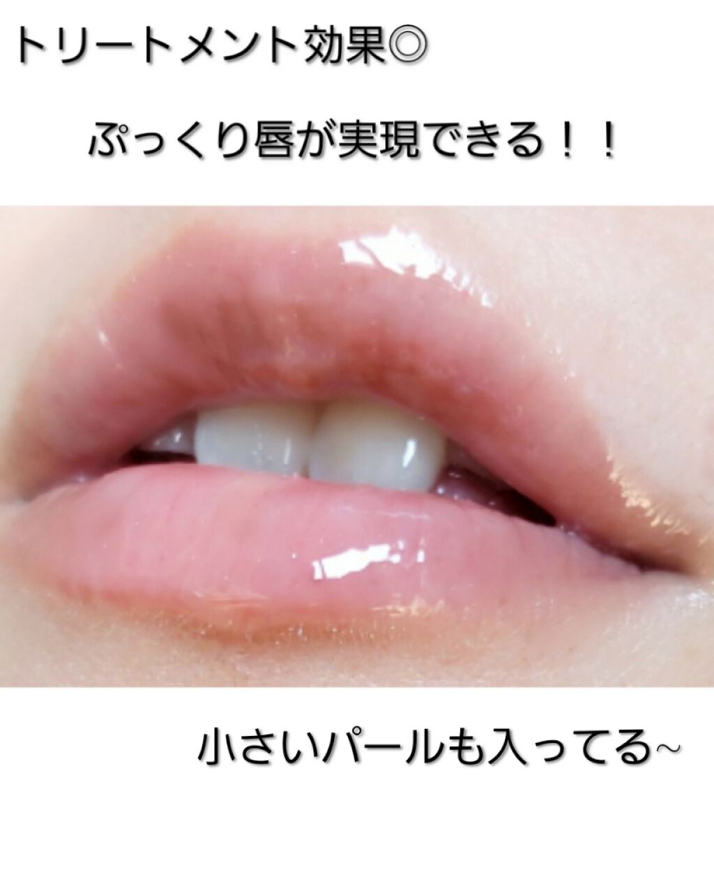 モイストリップジェル/&be/リップオイルを使ったクチコミ(3枚目)