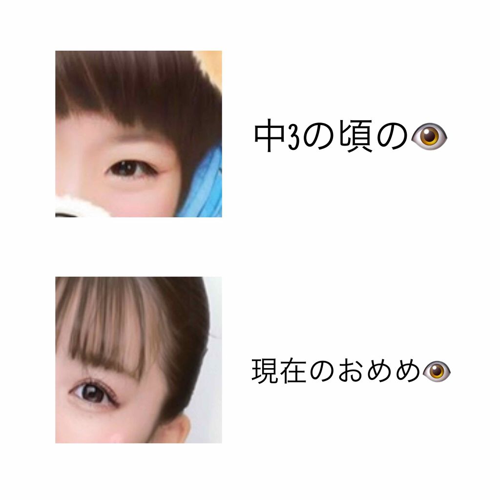 ハイブリッドフィルム/アイトーク/二重まぶた用アイテムを使ったクチコミ(1枚目)