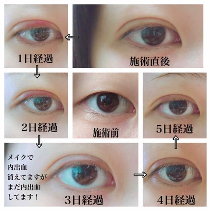 äºéæŽåœ¢/ãã®ä»ã䜿ã£ãã¯ãã³ãïŒ2æç®ïŒ