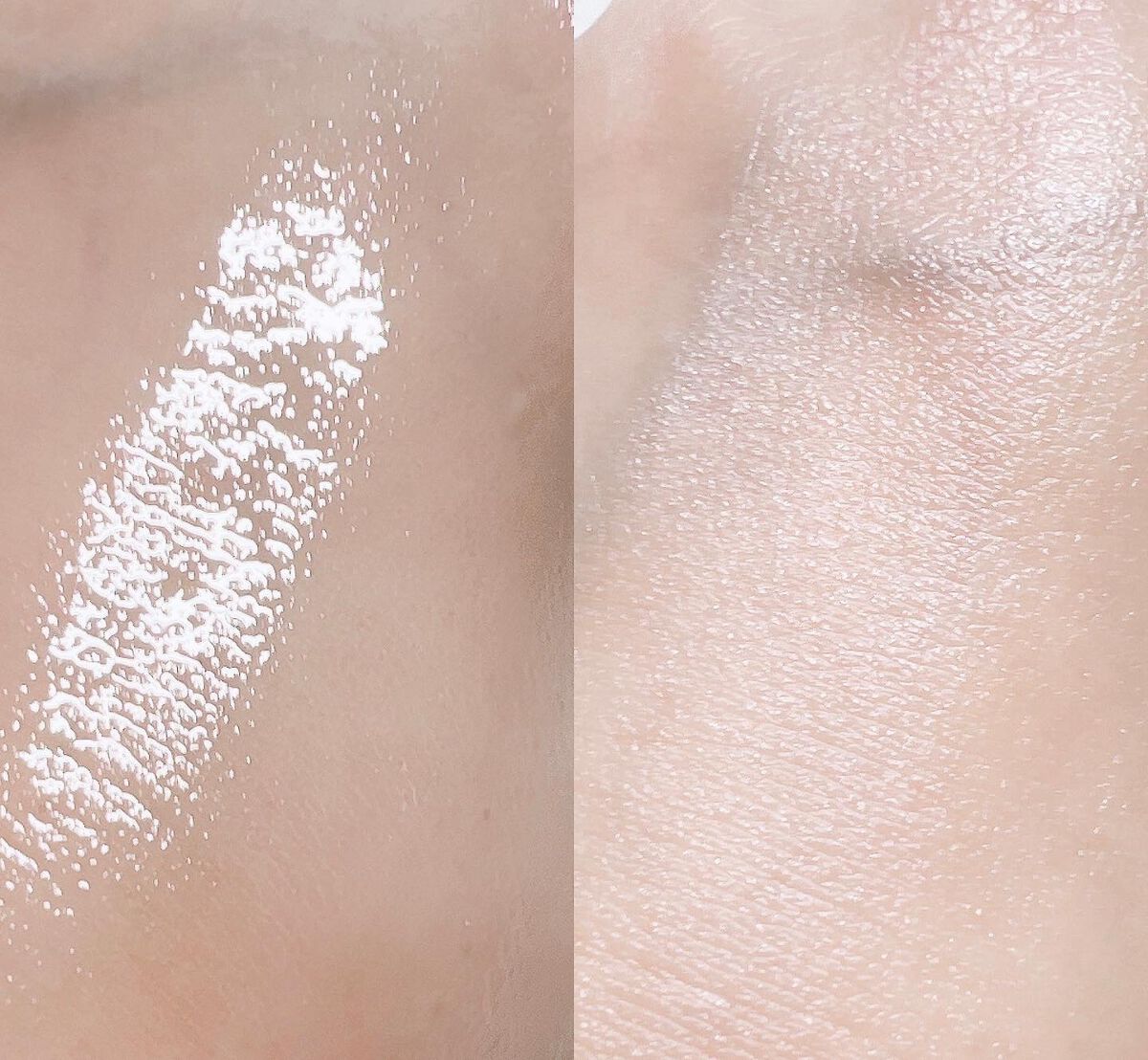 バイオイル/バイオイル/フェイスオイルを使ったクチコミ(4枚目)