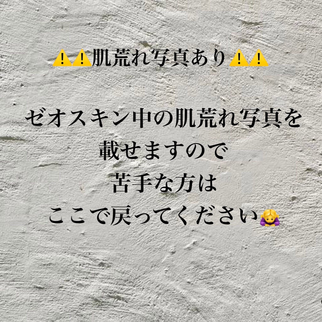 RCクリーム/ZO Skin Health/フェイスクリームを使ったクチコミ(3枚目)