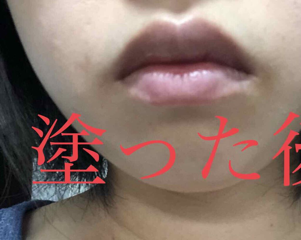 リンキーフラット/北の快適工房/美容液を使ったクチコミ(3枚目)