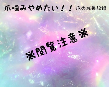 ※※※3枚目4枚閲覧注意です！！！※※※

子供の頃（記憶では小学生低学年の頃）から
爪噛みがやめれない私……


現在20を超えて数年経ってるのにいまだにやめれていません。
いろんな方のネイルを見てい