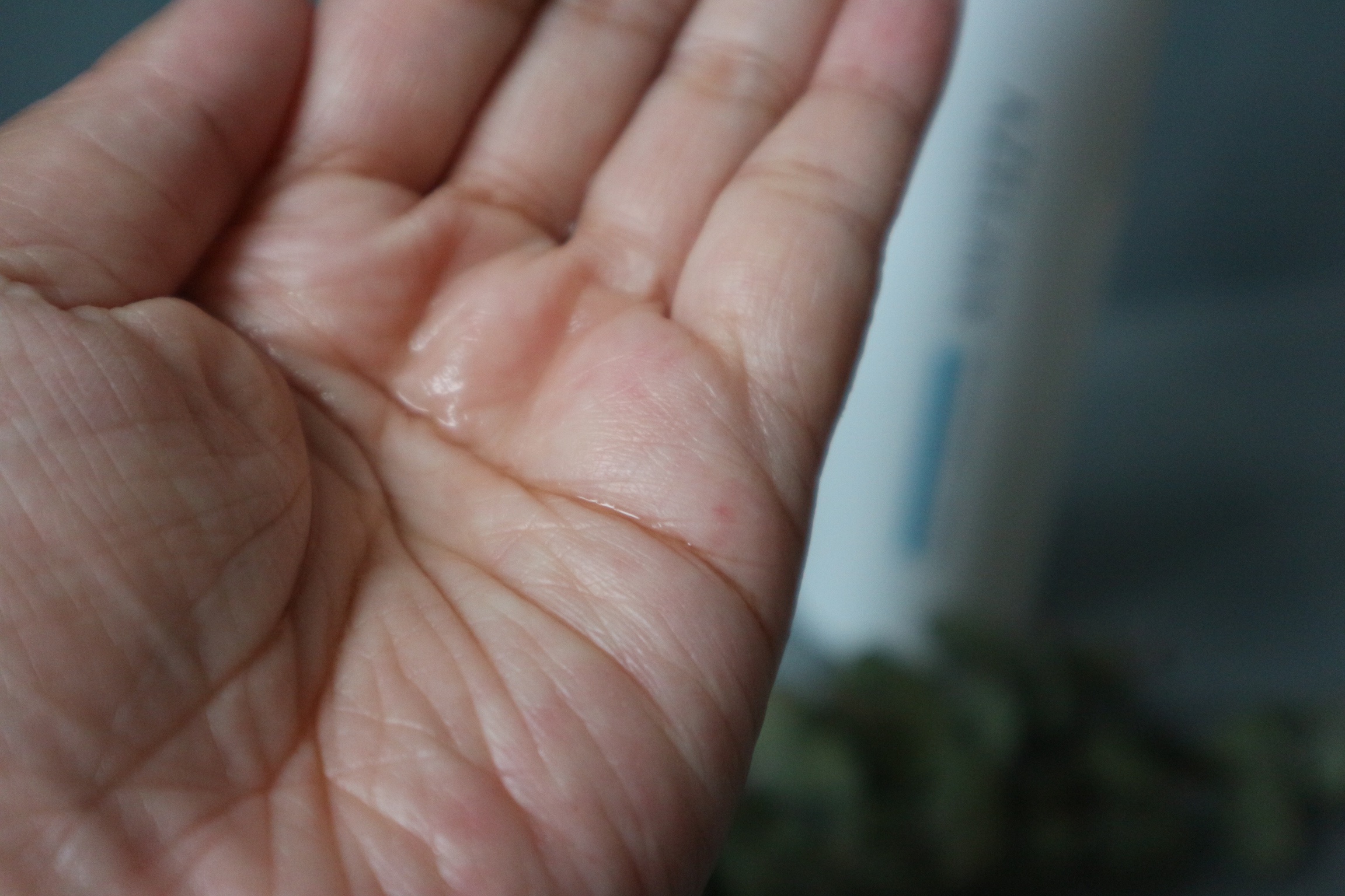 AZLAIN　化粧水　AZバランシングローション/AZELAIN/化粧水を使ったクチコミ（2枚目）