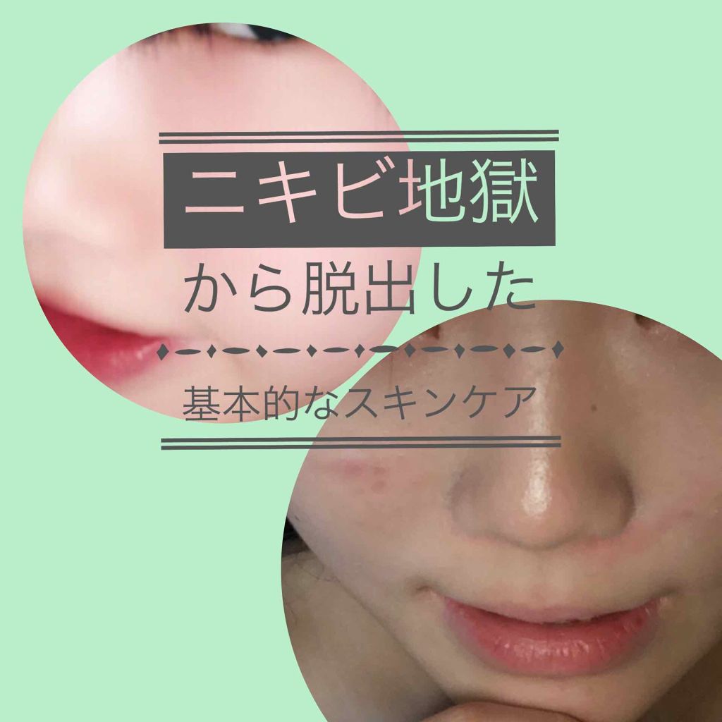 テラ・コートリル 軟膏(医薬品)/ジョンソン・エンド・ジョンソン/その他を使ったクチコミ（1枚目）