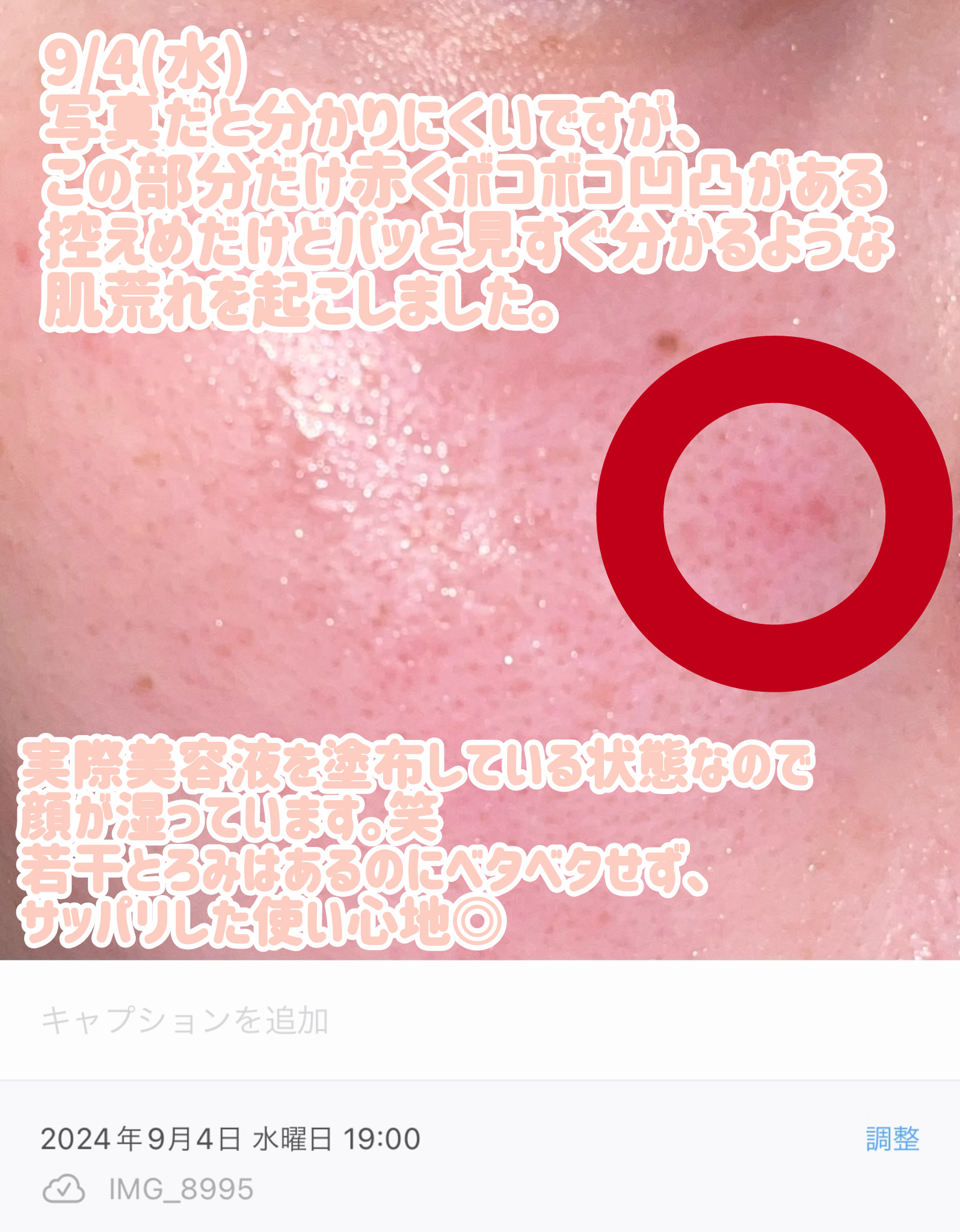 RXザ・ナイアシンアミド15セラム  /COSRX/美容液を使ったクチコミ（3枚目）