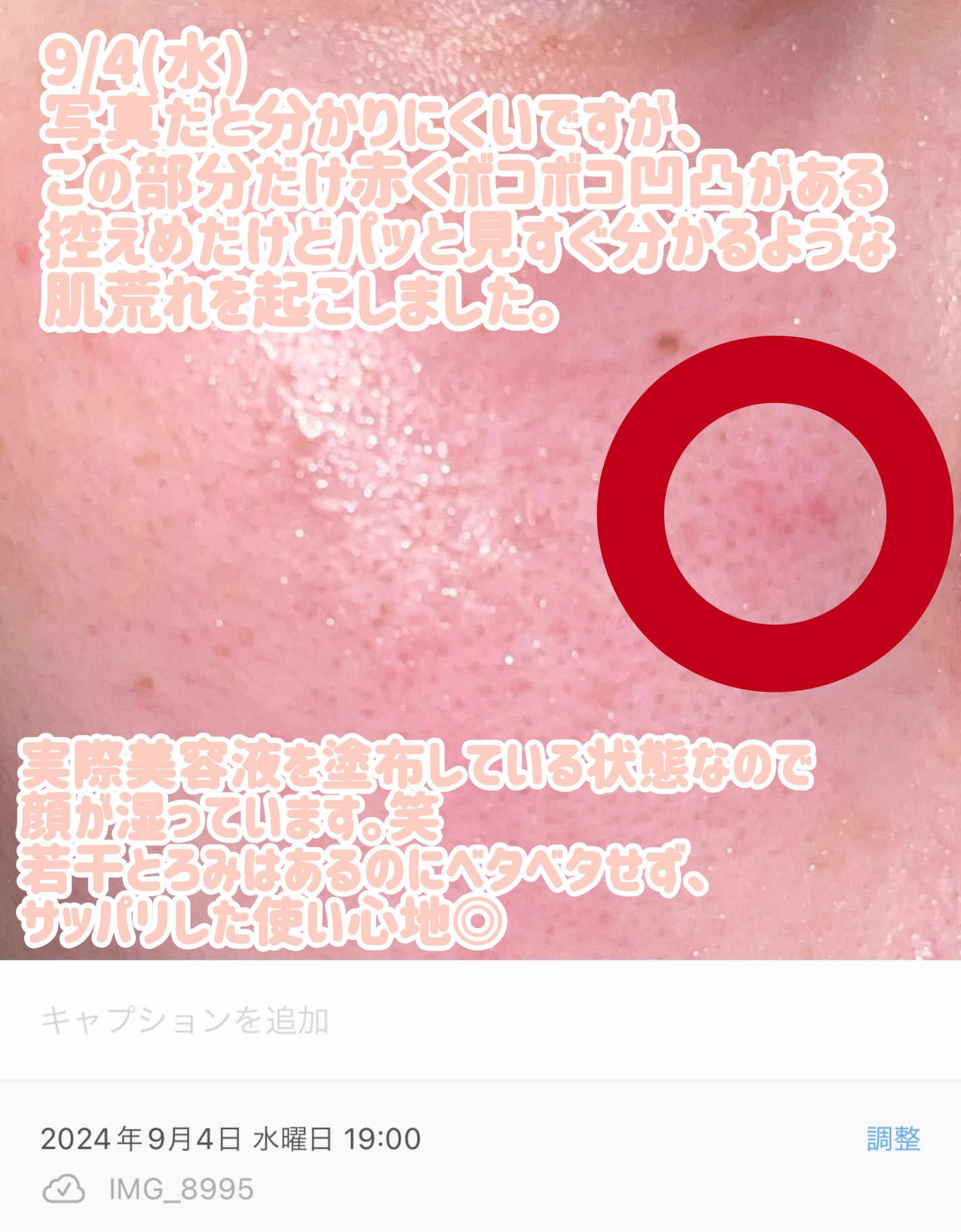 RXザ・ナイアシンアミド15セラム  /COSRX/美容液を使ったクチコミ(3枚目)