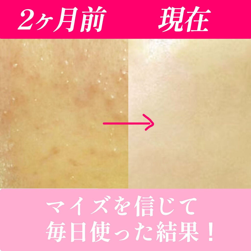 my's パーソナライズセラム/my's/美容液を使ったクチコミ(2枚目)