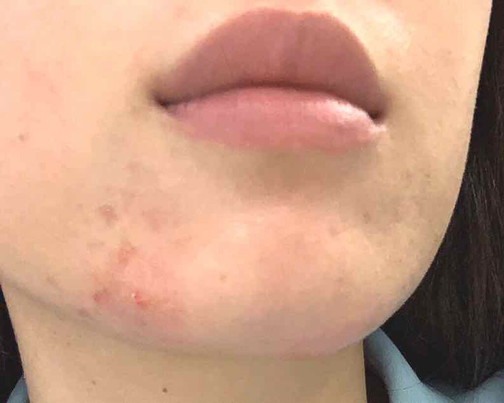 フローラドリップ/ALBION/化粧水を使ったクチコミ(3枚目)