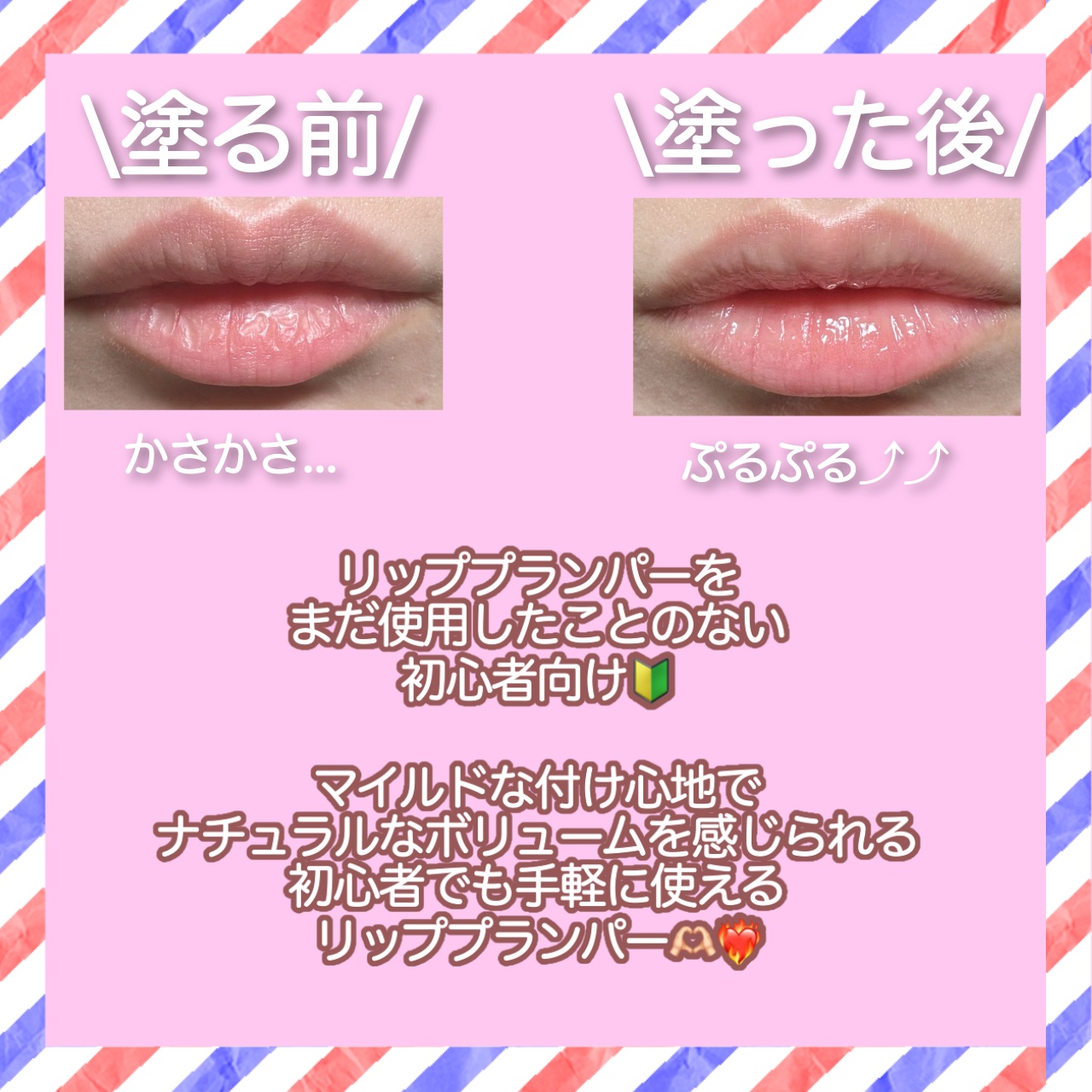 リードルS リッププランパービギナー/VT/リッププランパーを使ったクチコミ（2枚目）