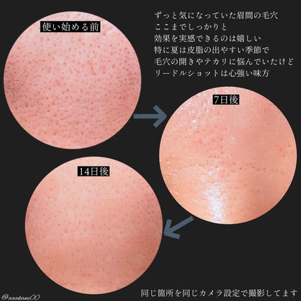 CICA デイリースージングマスク/VT/シートマスク・パックを使ったクチコミ(7枚目)