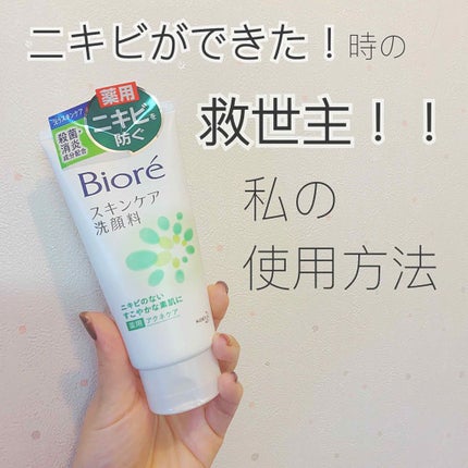 スキンケア洗顔料 薬用アクネケア/ビオレ/洗顔フォームを使ったクチコミ(1枚目)