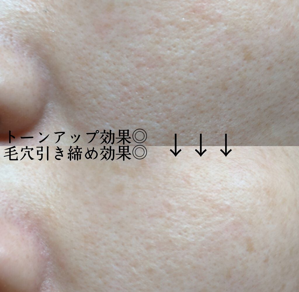 リフトブライトCO2パック/yourline/シートマスク・パックを使ったクチコミ(4枚目)