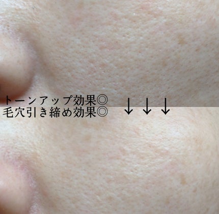 リフトブライトCO2パック/yourline/シートマスク・パックを使ったクチコミ(4枚目)