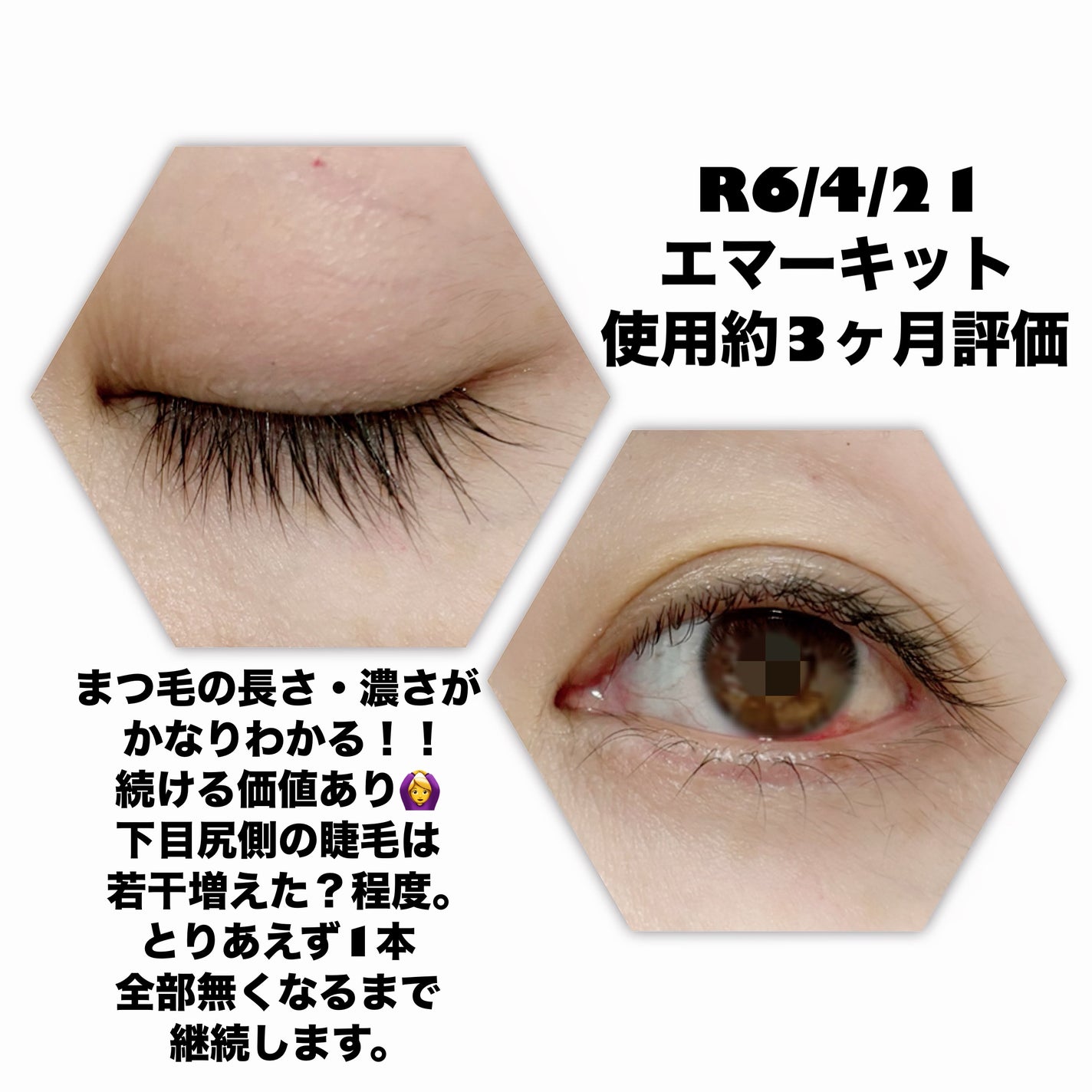 EMAKED(エマーキット)/水橋保寿堂製薬/まつげ美容液を使ったクチコミ(1枚目)