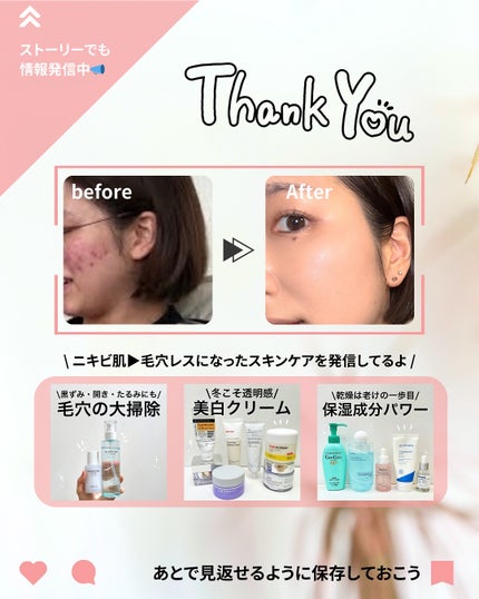 DW-EGFワンデイズアンプル/Easydew/美容液を使ったクチコミ(7枚目)